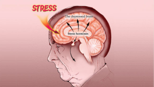 Stress Illustration